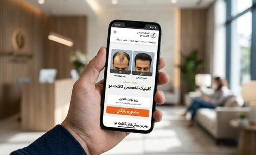 تبلیغ وب‌سایت کلینیک کاشت مو در صفحه موبایل از نمای نزدیک در دست فردی با پس زمینه مات کلینیک