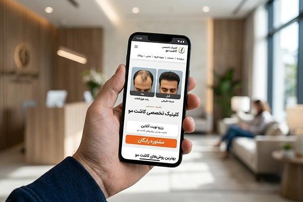 تبلیغ وب‌سایت کلینیک کاشت مو در صفحه موبایل از نمای نزدیک در دست فردی با پس زمینه مات کلینیک