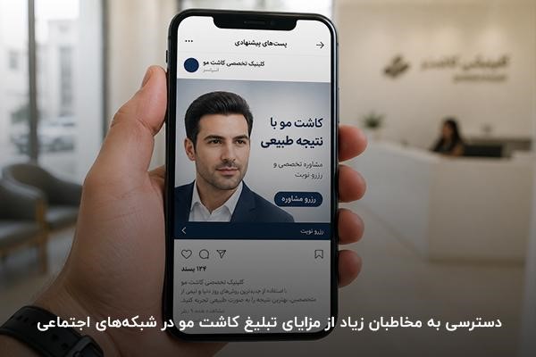 صفحه تبلیغ کلینیک کاشت مو در اینستاگرام در نمایشگر موبایل در دست شخصی از نمای نزدیک